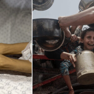 bmden gazzedeki insani durumla ilgili aciklama artik felaketin otesinde QErlsATm