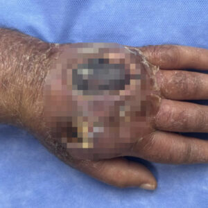 hirsizin isirigi kolundan ediyordu vaka literature girmeye aday OOh59uhb